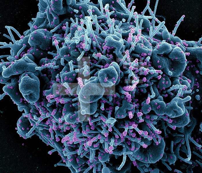 Colorized scanning electron micrograph of an apoptotic cell (teal) infected with SARS-COV-2 virus particles (purple), isolated from a patient sample. Image captured at the NIAID Integrated Research Facility (IRF) in Fort Detrick, Maryland.