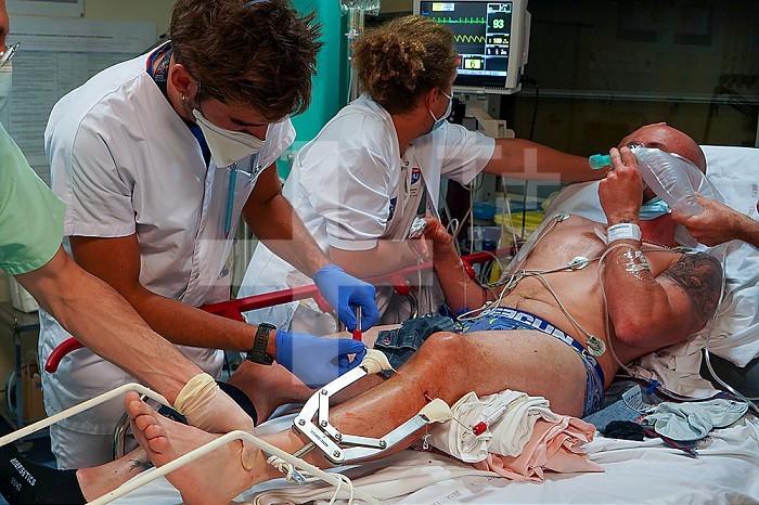 Patient in the shock ward in the intensive care unit of a university hospital. Transosseous traction is performed in anticipation of an operation that will take place the next morning.