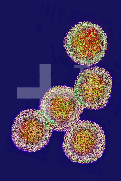 Influenza virus. Viruses of the Orthomyxoviridae family. Avian plague virus. The flu virus is the cause of an infectious and contagious respiratory disease. It evolves into a major pandemic interspersed with small localized seasonal epidemics. Virus diameter: about 100 nm. Computer graphics on transmission electron microscope view.