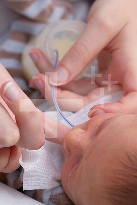 Neonatology service. Childcare nurse feeding a premature baby using a probe. She stimulates the sucking reflex with her finger in the premature baby´s mouth.