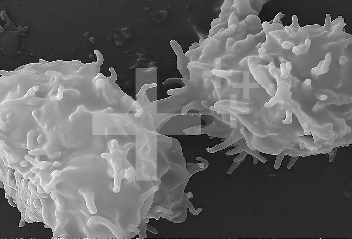 This scanning electron microscope (SEM) image revealed two Acanthamoeba polyphaga protozoa, as they interacted through their numerous pseudopodia, projecting from the surface of these organisms. These pseudopodia allow amoebas to move and grasp objects in their environment. In this particular case, it was not known whether these two amoebas were communicating, or coming to the conclusion of mitotic cell division, becoming separate organisms. CDC/Catherine Armbruster Margaret Williams 2009