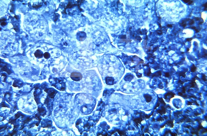 Under 900X magnification, this photomicrograph revealed the presence of a number of trophozoites of the parasitic organism, Entamoeba histolytica, strain J93, in this tissue sample which was harvested from a rat and prepared using Kohn´s staining method. CDC/Dr Healy 1964