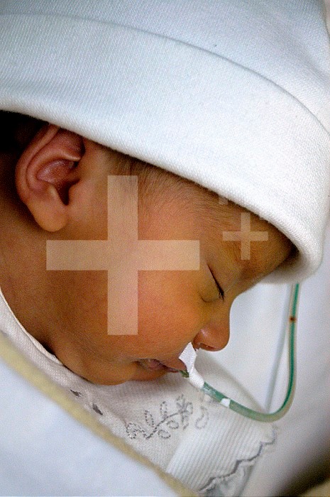 Reportage in the neonatal unit of Robert-Debre hospital in Paris, France. Feeding tube.