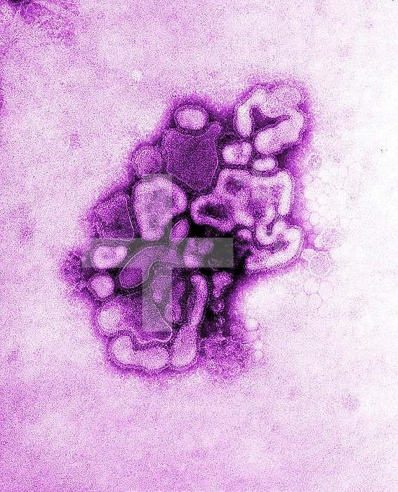 Under a plate magnification of 37,800X, this colorized transmission electron micrograph (TEM) depicted a strain of swine flu, the A/New Jersey/76 (Hsw1N1) virus, while in the virus first developmental passage through a chicken egg. Swine Influenza (swine flu) is a respiratory disease of pigs caused by type A influenza that regularly cause outbreaks of influenza among pigs. Swine flu viruses cause high levels of illness and low death rates among pigs. Swine influenza viruses may circulate in swine throughout the year, but most outbreaks among swine herds occur during the late fall and winter months similar to humans. The classical swine flu virus (an influenza type A H1N1 virus) was first isolated from a pig in 1930.