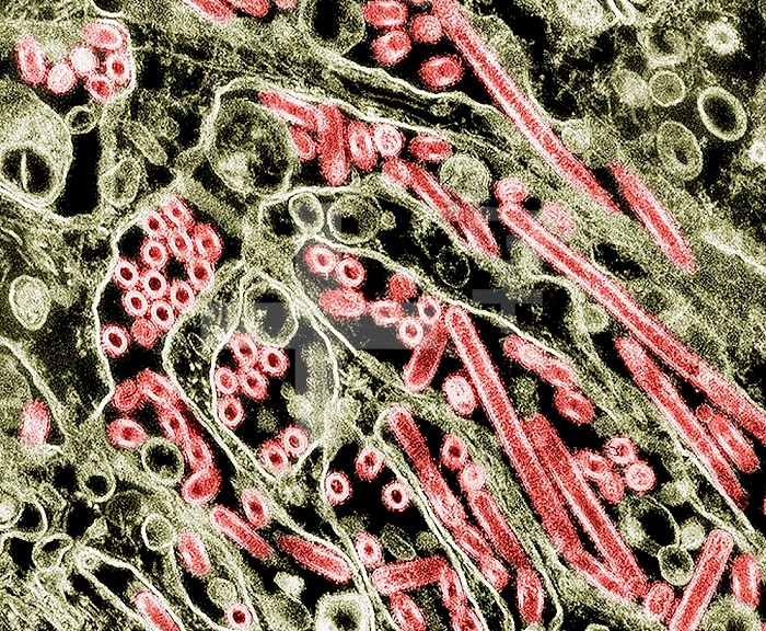Colorized transmission electron micrograph of Avian influenza A H5N1 viruses grown in MDCK cells. Avian influenza A viruses do not usually infect humans; however, several instances of human infections and outbreaks have been reported since 1997. When such infections occur, public health authorities monitor these situations closely.